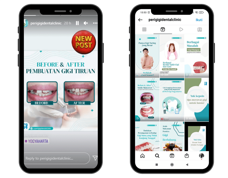 Pelayanan Kelola Instagram dari Creativism